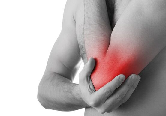 Gonfiore e dolore acuto all'articolazione sono segni dell'ultimo stadio dell'artrosi